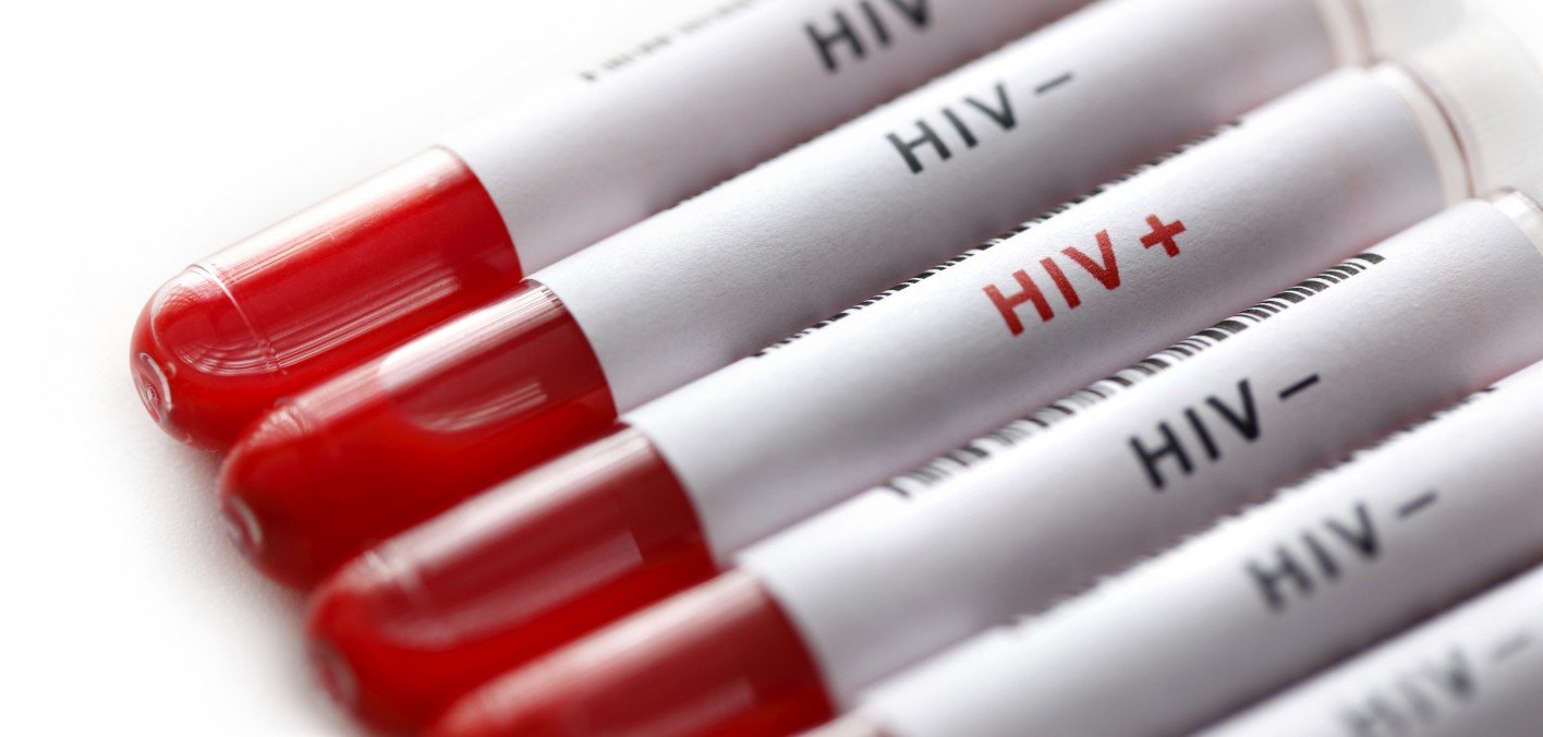 alliance in fight against HIV/AIDS